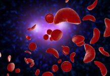 जिल्ह्यात सिकलसेलचे 42 हजार 389 वाहक, 3 हजार रुग्ण